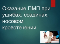 Оказание ПМП при ушибах, ссадинах, носовом кровотечении