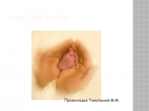 Презентация к уроку О плоскостопии