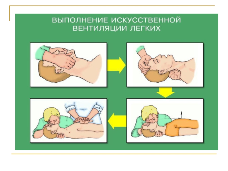 Экстренная реанимационная помощь обж 9 класс презентация