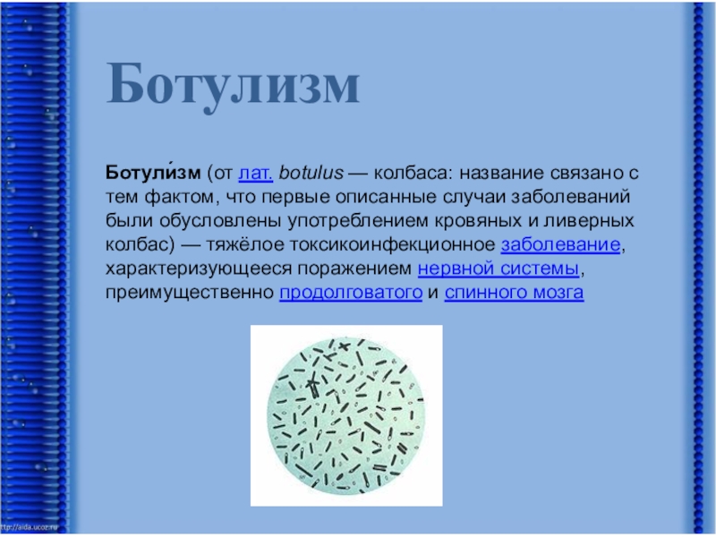 Чаще всего ботулизм связан с употреблением ответ. Понятие о микроорганизмах. Факты о микробах. Ботулизм.