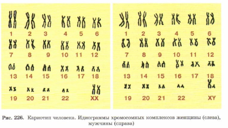 Хромосомы здоровой женщины. Идиограмма кариотипа. Кариотип человека. Нормальный кариотип человека. Мужской кариотип.