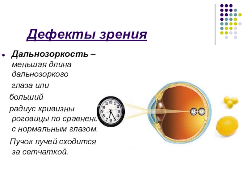 Презентация на тему дальнозоркость