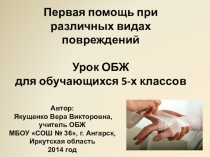 Презентация по ОБЖ Первая помощь при различных видах повреждений (5 класс)