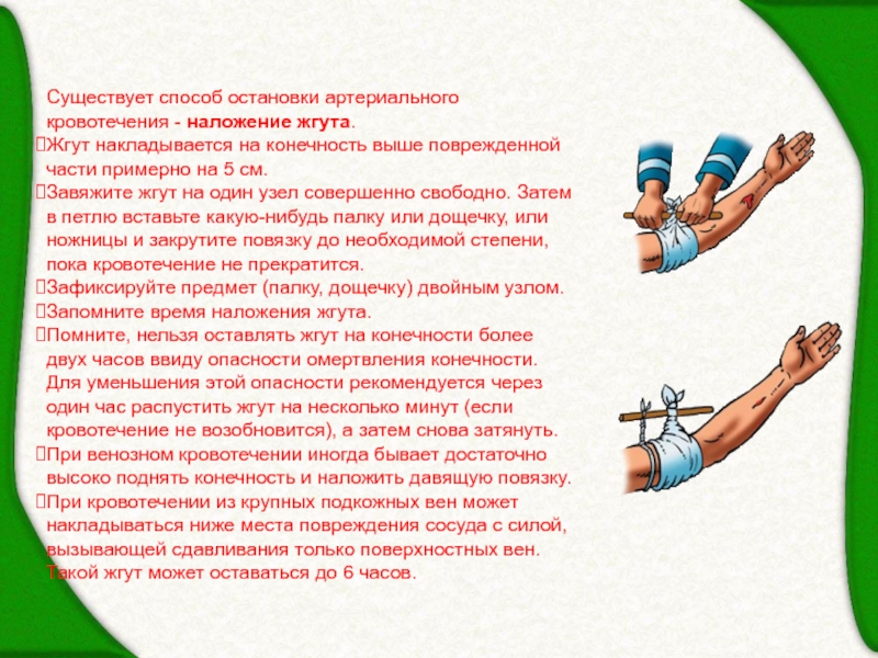 Жгут на конечность на какое время. Наложение жгута при остановке кровотечения. Способы остановки кровотеченияналожение жнута. Наложение жгута для остановки кровотечения. Артериальное кровотечение наложение жгута.