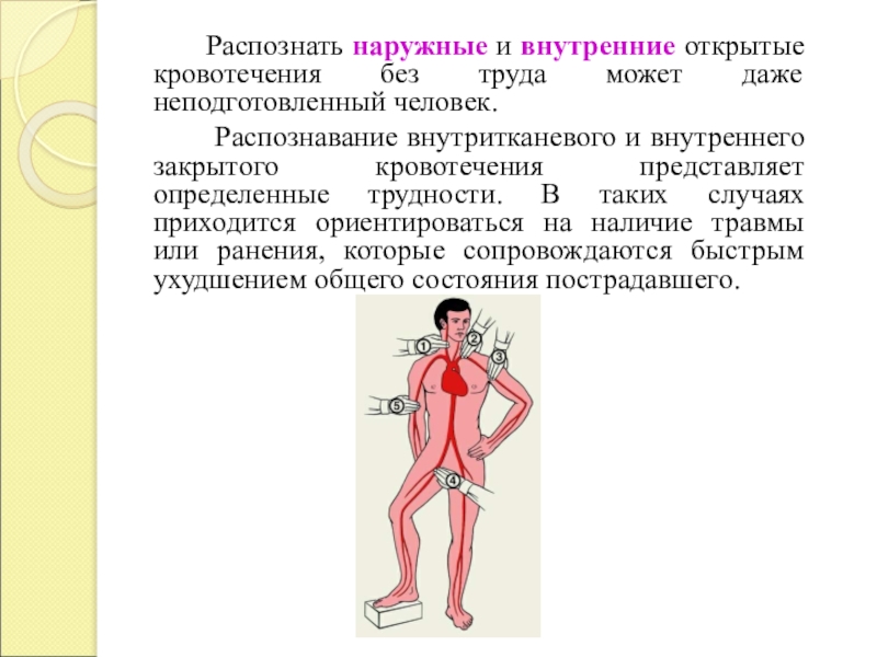 Внутреннее открытое. Наружные и внутренние кровотечения. Внутреннее и внешнее кровотечение. Внутренние открытые кровотечения. Наружные внутренние и скрытые кровотечения.