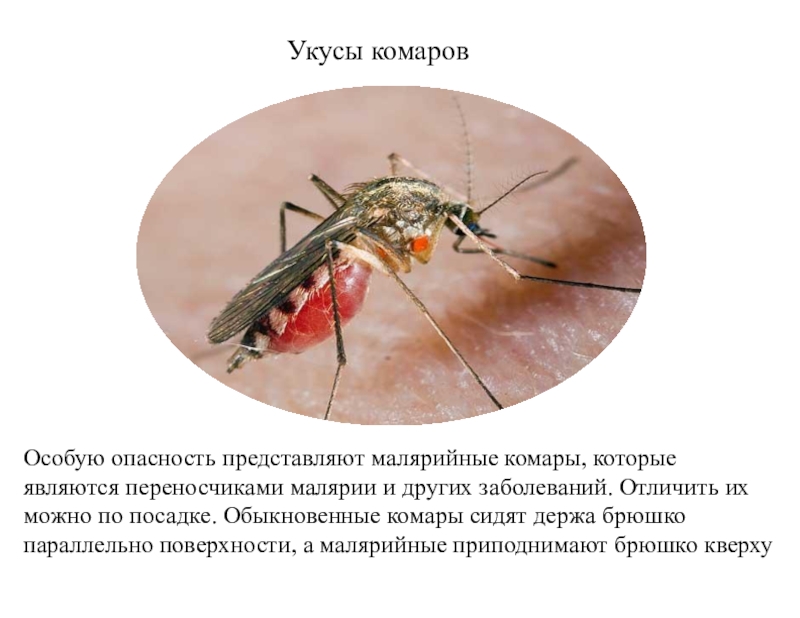 Малярийная муха. Ложный малярийный комар. Комар переносчик малярии малярийный комар. Укусы комаров малярийный комар. Укус малярийного комара симптомы.