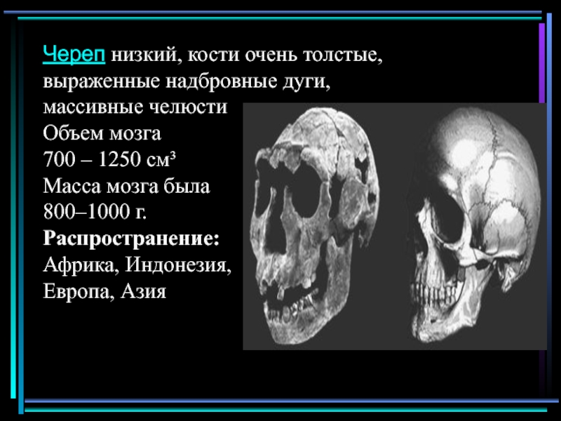 Ниже кости. Череп низкий кости очень толстые выраженные надбровные. Кости черепа надбровные дуги. Череп с выраженными надбровными дугами.