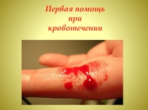Презентация для урока по окружающему мируПервая помощь при кровотечении