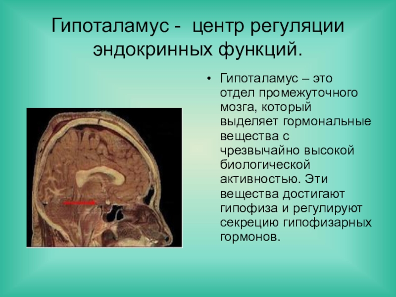 Реферат: Гіпоталамус