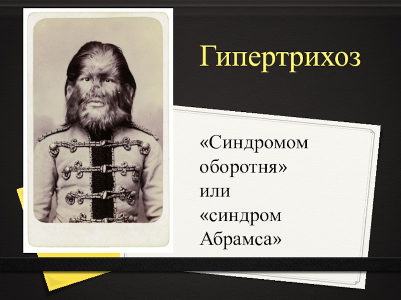 Наследование гипертрихоза. Гипертрихоз или синдром оборотня. Гипертрихоз презентация.