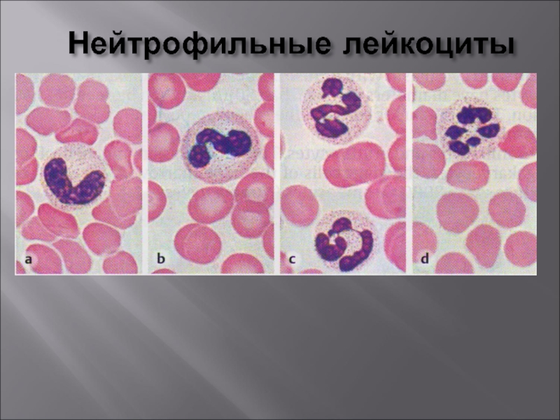 Лимфа тканевая. Нейтрофильный лейкоцитоз гистология. Кровь ткань рисунок. Кровь и лимфа гистология. Нейтрофильные клетки.