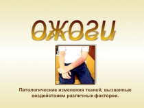 Ожоги- презентация по первой медицинской помощи