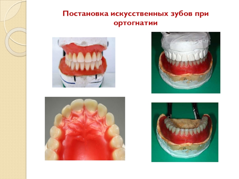 Искусственные зубы и их виды презентация