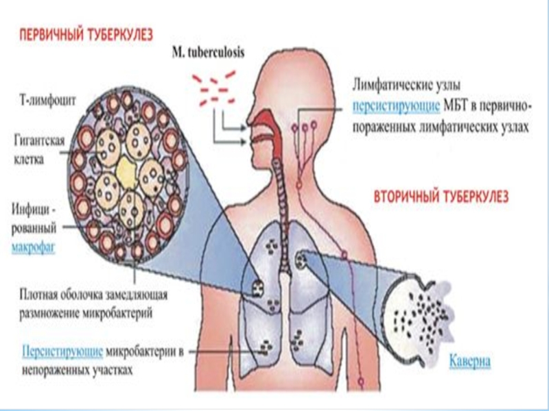 Вакцинация туберкулеза схема