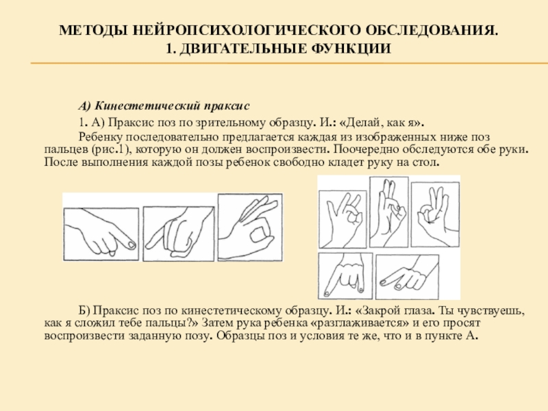 Праксис поз по зрительному образцу