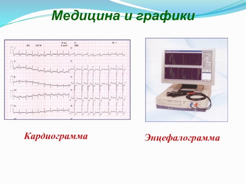 Медицина и графикиКардиограммаЭнцефалограмма