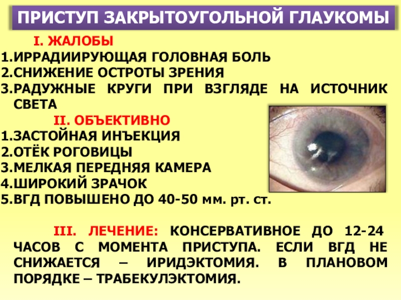 При глаукоме можно применять. Первичная закрытоугольная глаукома. Приступ закрытоугольной глаукомы. Острый приступ открытоугольной глаукомы. Клиника закрытоугольной глаукомы.