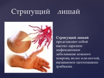 Презентация по биологии Стригущий лишай (6 класс)