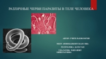 Презентация Различные черви паразиты в теле человека