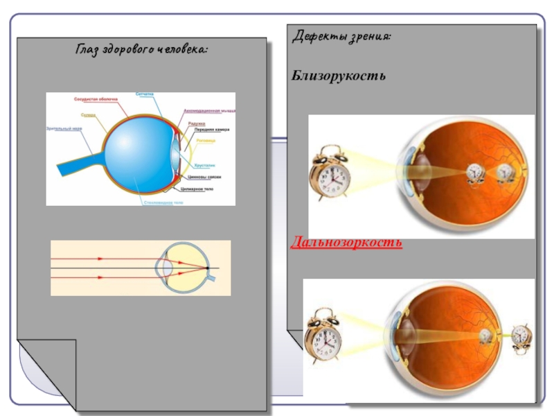 Дефекты зрения презентация по физике