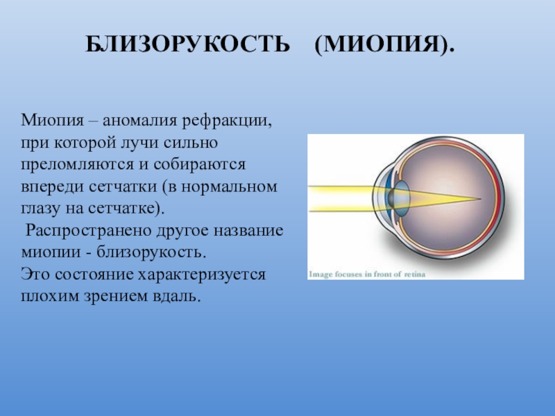 Презентация биология 8 класс заболевания глаз