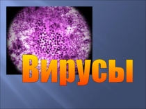 Презентация по биологии на тему :Вирусы