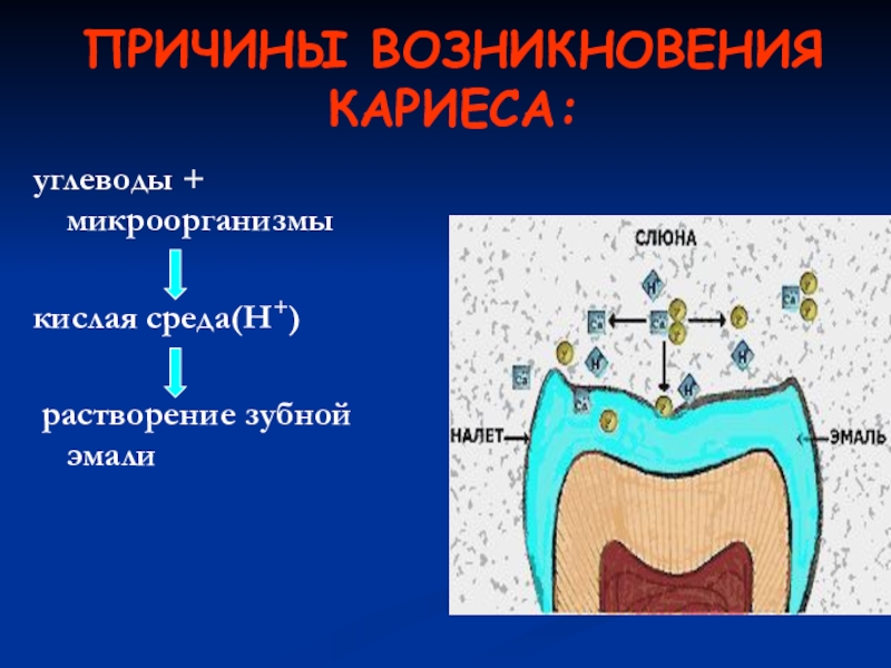 Теория возникновения кариеса презентация