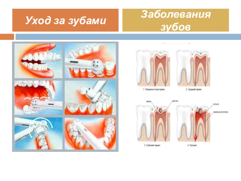 Заболевания зубов какие бывают фото