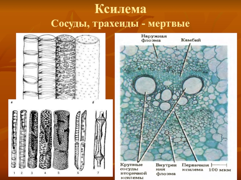 Сосуды ткань. Сосуды ксилемы строение. Сосуды и трахеиды ксилемы. Ксилема ткань растений. Ткань сосуды ксилемы.