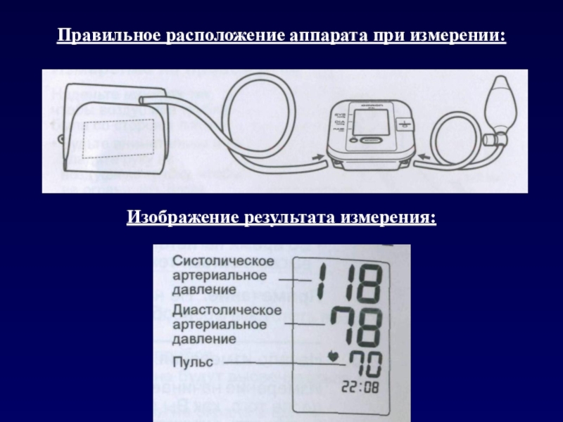 Положение аппарате. Конструкция измеритель артериального давления. Измерение давления полуавтоматическим тонометром рисунок. Измерение ад Результаты. Расположение прибора при измерении.