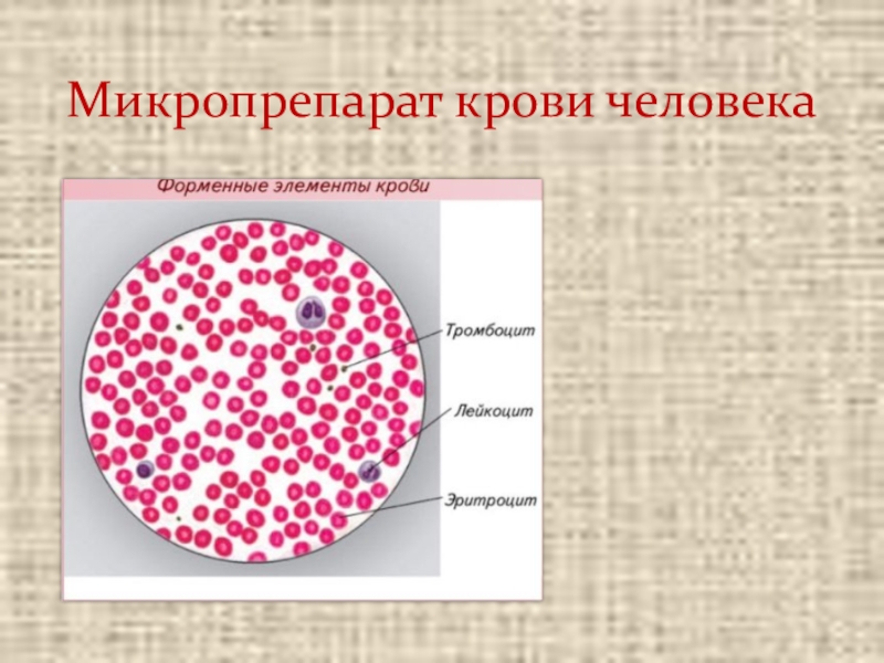 Эритроцит ткань. Микропрепарат крови человека под микроскопом. Микропрепарат крови лягушки под микроскопом. Мазок крови лягушки гистология. Лейкоциты в крови лягушки под микроскопом.