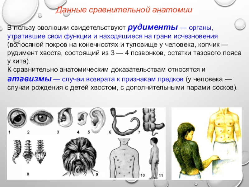 Атавизмам относят. Атавизмы и рудименты человека. Рудименты и атавизмы человека биология 8 класс. Рудименты и атавизмы доказательства эволюции. Рудименты и атавизмы таблица.