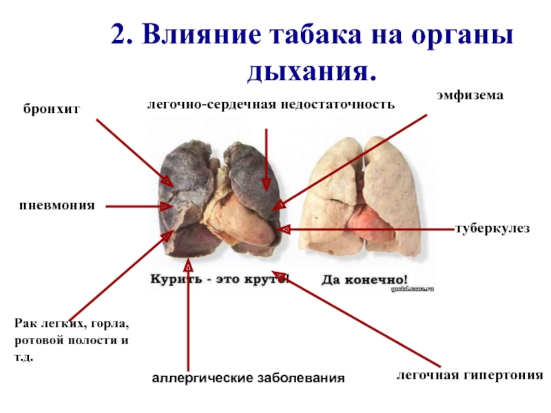 Презентация влияние курения на дыхательную систему