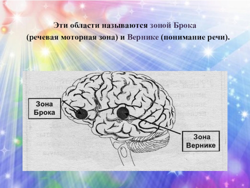 Зона брока и вернике. Зона Брока. Ионизатор физика 10 класс зона Брока.