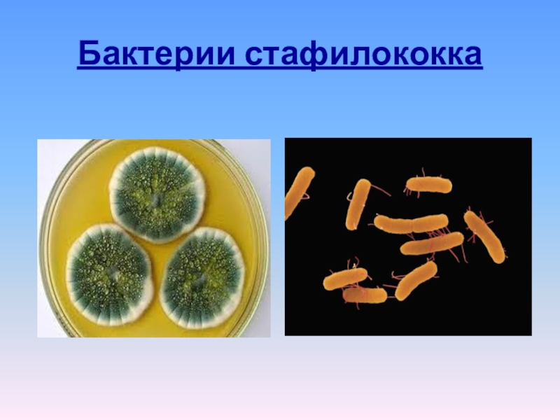 Staphylococcus aureus 5. Бактерии стафилококки. Бактерия золотистый стафилококк. Стафилококк условно патогенный микроорганизм. Стафилококковая инфекция бактерия.
