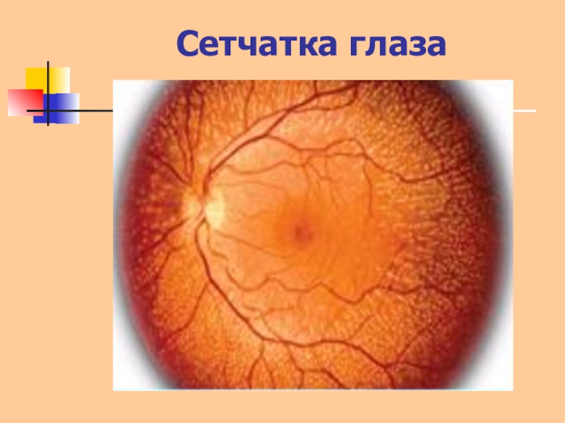 Работа сетчатки. Пигментный ретинит сетчатки. Сетчатка глаза. Сетчатка оболочка глаза. Сетчатая оболочка глаза.