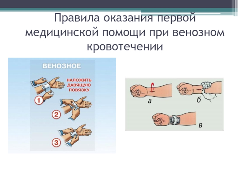 Презентация по обж кровотечения