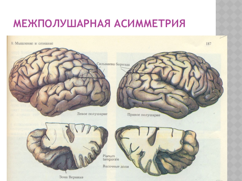 Межполушарная асимметрия