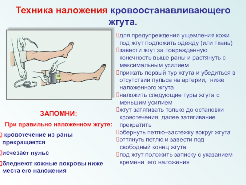 Жгут выше раны. Показания к наложению кровоостанавливающего жгута. Ошибки при наложении кровоостанавливающего жгута. Отек легких жгуты на конечности. Кровотечение останавливается туром жгута.