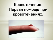 Презентация по ОБЖ Помощь при кровотечении