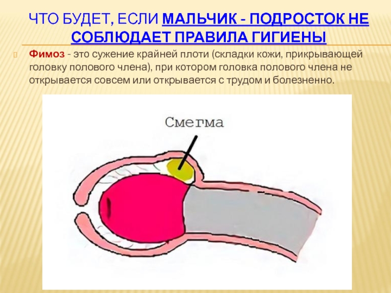 Почему головка члена не открывается