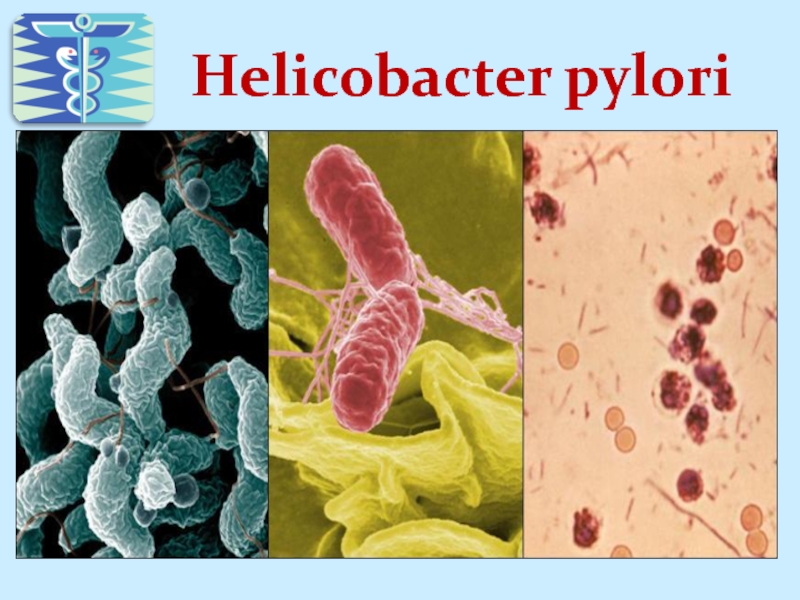 Helicobacter pylori фото