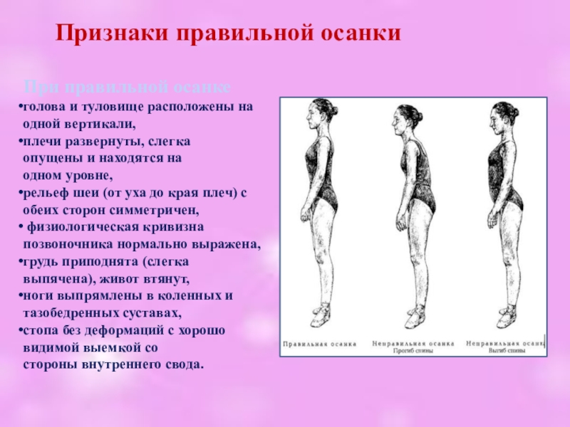 Презентация по теме осанка