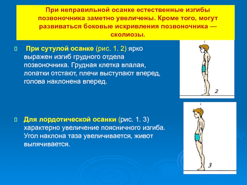 Правильная осанка обеспечивает