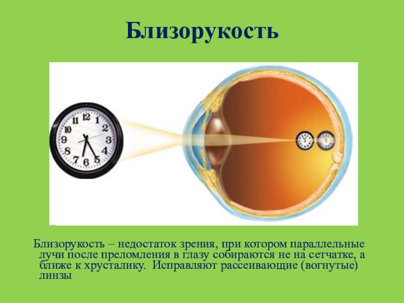 Доклад по физике на тему зрение. Оптическая система глаза. Оптическая система глаза презентация. Дефекты зрения физика. Оптическая система глаза физика.