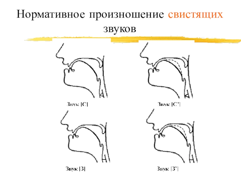 Свистящие звуки. Произношение свистящих. Нормативное произношение. Виды нарушения произношения свистящих звуков.