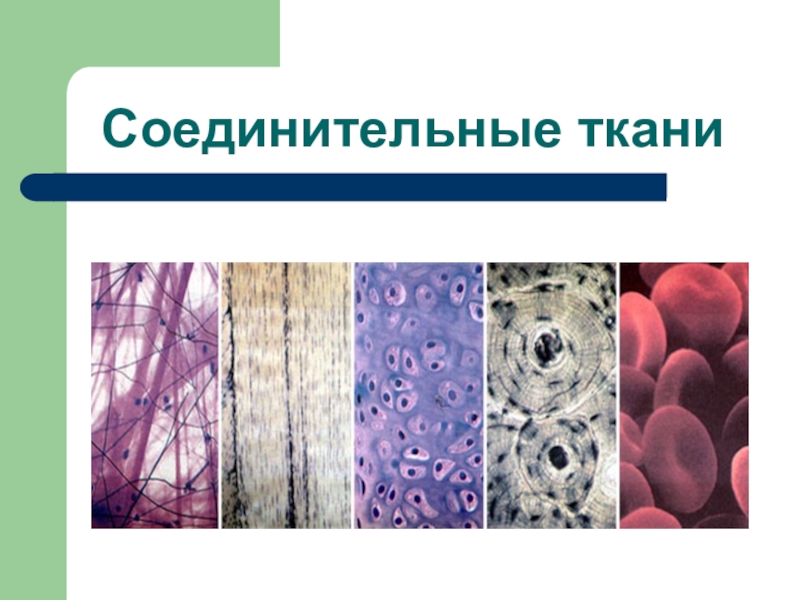 Ткань 1 соединительная. Соединительная ткань ткань 5 класс биология. Биология ткани животных соединительная. Соединительная ткань 5 класс биология. Ткани животных 5 класс биология соединительная ткань.