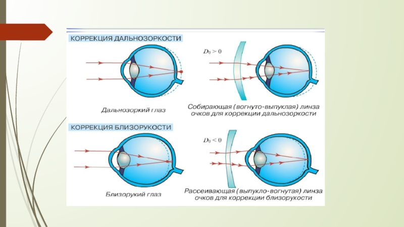 Презентация глаз как оптическая система 7 класс