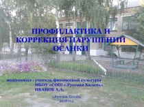 Профилактика и коррекция нарушения осанки