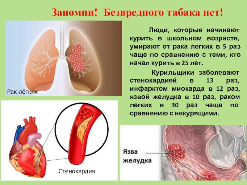 Рак легких это. Презентация на тему безвредного табака не бывает. Презентация безвредного табака не бывает классный час. Безвредного табака не бывает картинки. Безвредных сигарет не бывает плакат.